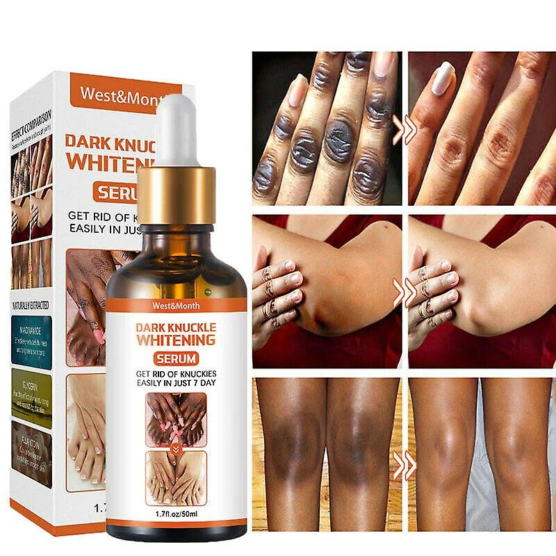 Dark Elbow, Knee And Knuckle Whitening Serum In Waterloo In Nebraska, United States Call ☏ +2771 073 2372 Get Rid Of Tattoos And Dark Spots In Kärsta Municipality in Sweden